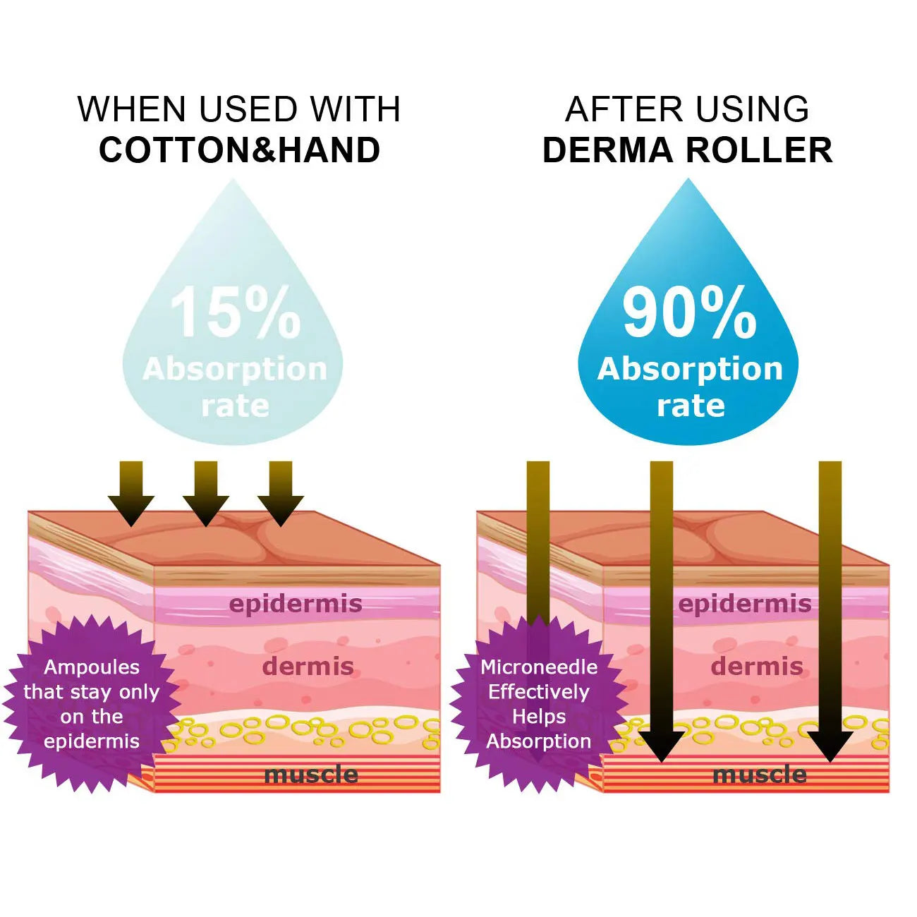 Luxury Golden DRS 540 Derma Roller Micro Needle